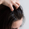 Dandruff